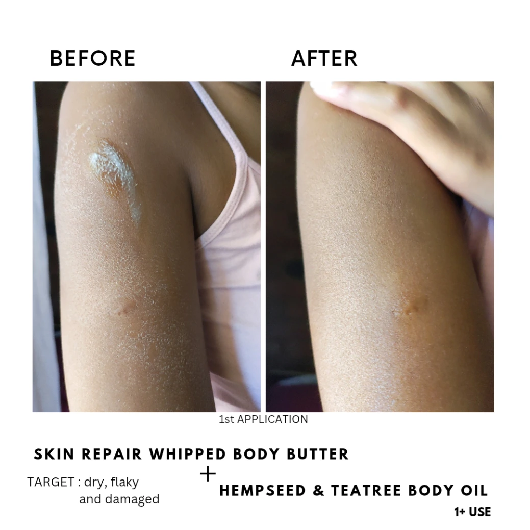 Damaged skin repair reviews